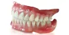 Dentures Treatment in Race Course|Dentures Treatment in Coimbatore