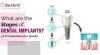 What Are The Stages Of Dental Implants? A Comprehensive Guide
