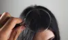 Dandruff vs Dry Scalp: How to Tell the Difference and Treat Accordingly
