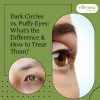 dark_circles_vs._puffy_eyes_whats_the_difference_how_to_treat_them.jpg