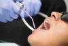 What are The Importance and Benefits of Dental Bridges