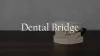 Dental Bridges – Types &amp; Cost of Dental Bridges Houston