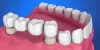 Best Dentist In BTM Layout Bangalore Near Me | Sabka Dentist