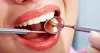 POINTS THAT CAN BE CONSIDERED FOR GETTING BEST COSMETIC DENTIST