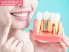 Best Dental Clinic in Palam Vihar Gurgaon - Smilessence