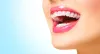 Root Canal Treatment