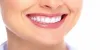 How Dental Crowns Can Restore Your Smile? | Papamommy