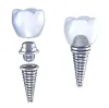 Dental Implants – Edge Dental Houston