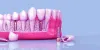 Dental Implants in Dwarka