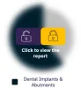  Dental Implants and Abutments Market Size (Value, Volume, ASP) by Segments, Share, Trend and SWOT Analysis, Regulatory and Reimbursement Landscape, Procedures, and Forecast, 2015-2030  