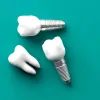 Dental Implants Dentist Houston – Professional Dentist for Dental Implants