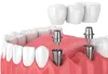 Best Dental Clinic in Gurgaon | Top Dentist in Gurugram - Ministry of Smile