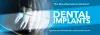  Dental Implant Memphis TN - Teeth Implant Jonesboro - Dental implants little rock Ar: Higginbotham Family Dental