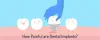How Painful are Dental Implants? | Will there be pain during surgery?