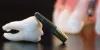 Best Implantologist for Dental Implants Treatments in Delhi,South Delhi, Greater Kailash