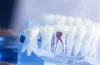Root Canal Melbourne | Root Canal Treatment Melbourne CBD | Holistic