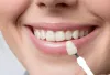 Best Dental Clinic in Gurgaon | Top Dentist in Gurugram - Ministry of Smile