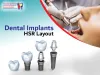 Steps to Choose The Best Dentist for Dental Implants