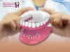Facts You Should Know About Dental Implants