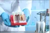 dental_crown.jpg