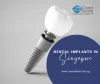 Dental Implant Singapore