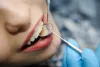 Dentist near me
