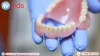 Same Day Dentures in Oregon | Emergency Dental Services