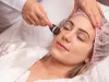 Dermaroller Treatment for Scars