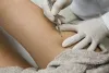 How Can You Find the Best Dermatologist for You - AtoAllinks