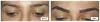  Scalp Micro Pigmentation &amp; Microblading | Certificate Course 