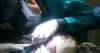 Direct Hair Transplant Doctor in Gurgaon