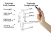 Stem Cell Therapy for Diabetes - Low Cost Treatment for Diabetes | stemcelltherapyinindia.com
