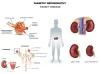 The Diabetic Kidney Disease Ayurvedic Treatment is effective