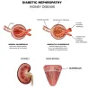 Can We Treat Diabetic Nephropathy Naturally?