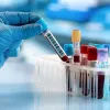 24 Hour Urgent Care Queens NY - New York Urgent Care Clinic - NYUCC
