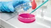 What Is Diethylaminoethyl Chloride hydrochloride stands for?