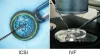 What is the main difference between IVF and ICSI? - Dynamic Fertility
