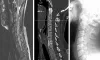   	Differences & Similarities Between X-Ray, CT scan and MRI | MDRC India  