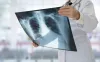 Best x-ray courses in pune, Maharashtra. | Adarsh Paramedical  