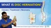 disc_herniation_video_thumbnail.jpg