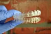 Invisalign Treatment in Houston, TX