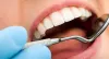 tooth extraction in bonham