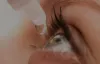 Most recommended optometrist in New Jersey with a new kind of eye care
