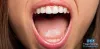 Why is My Mouth Dry?