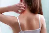 Dry Skin Rashes: Causes, Types, Home Remedies, Preventions