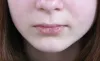 Why my lips are always dry and cracked? | Dry lips | WHYISTRENDING