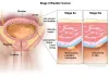 urinary bladder in female