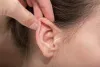Ear Surgery procedure