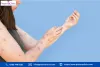 eczema hyperpigmentation