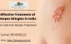 Herpes Cure- Effective Treatment of Herpes Shingles in India